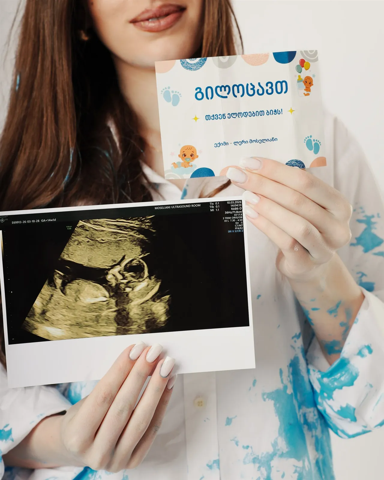 სქესის გაგების ფოტოსესია (gender reveal) ქუთაისში